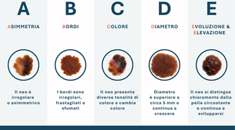 abcde-nei