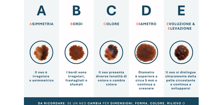 abcde-nei