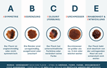 abcde-hautgesundheit-muttermale-haut-hautvera-nderungen-vorsorge-gesundheit-vh